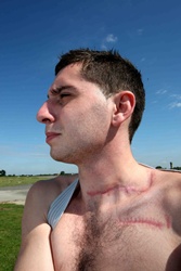 Tom Connelly's injury